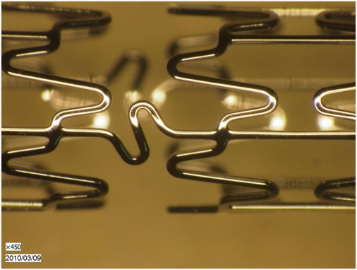 chitra cor coronary stent sctimst invasiv technologies